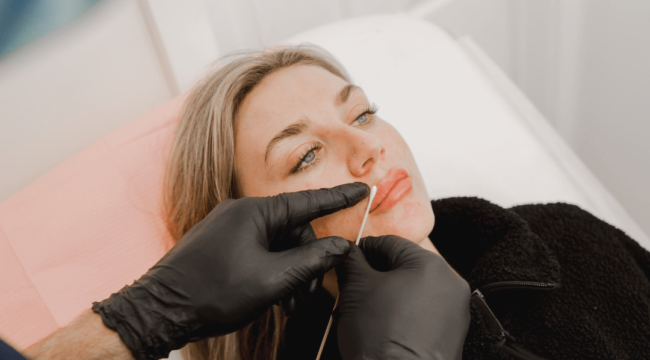 Lip enhancements at The Hestia Clinic