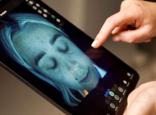 Observ520x Skin Analysis